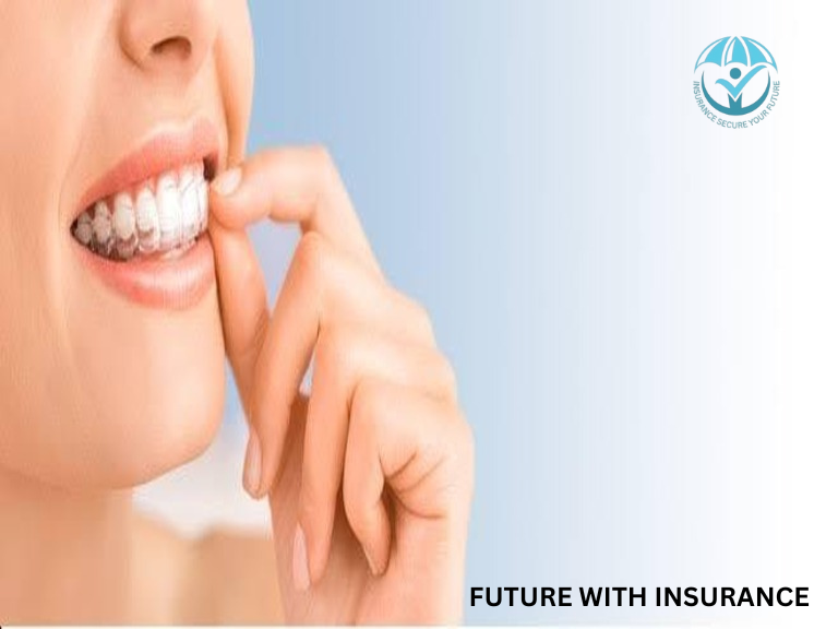 How Much is Invisalign With Insurance